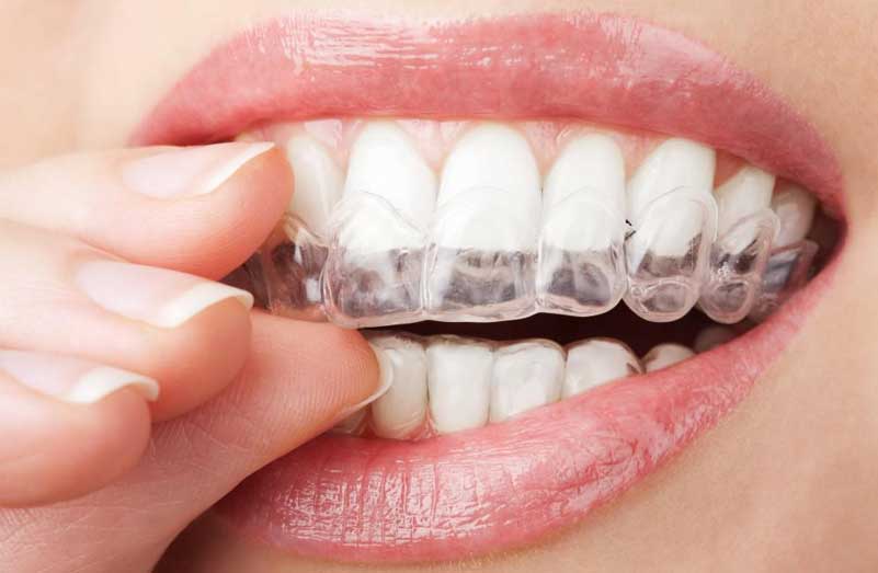 Dental Services in Sanger CA
